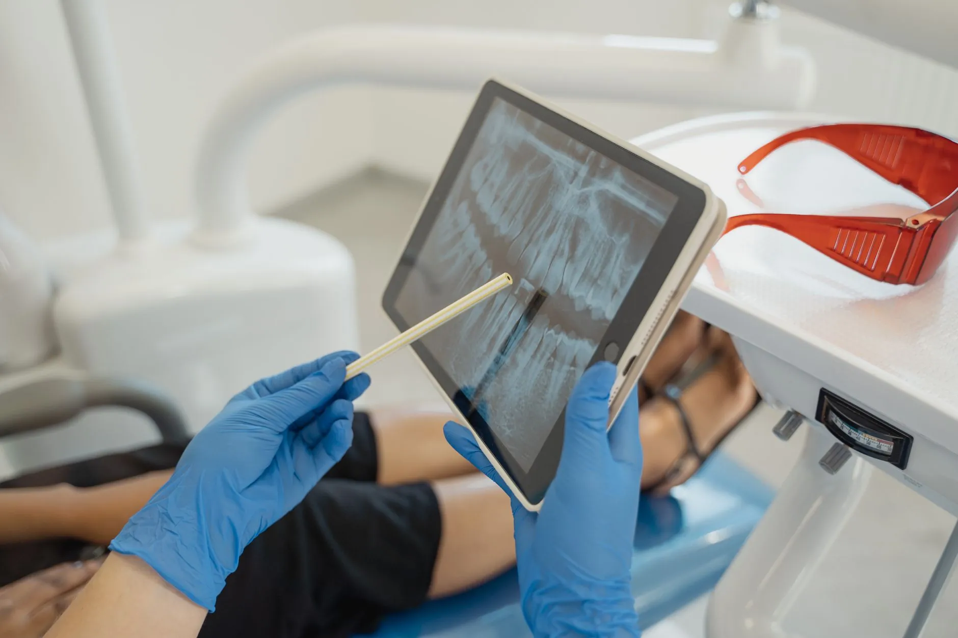 Dentista aponta uma radiografia panorâmica com implante na tela de um tablet