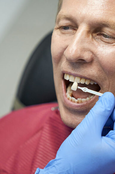 Facetas de Porcelana em Goiânia para Transformação do Sorriso