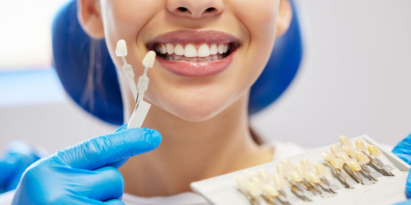 Facetas dentárias são para você? Entenda vantagens e contraindicações