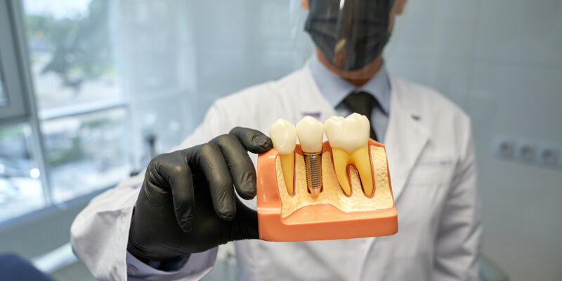 Prótese protocolo inferior e superior ao mesmo tempo; é possível?