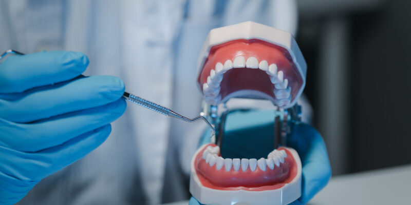 Guia completo sobre prótese protocolo: tire suas dúvidas