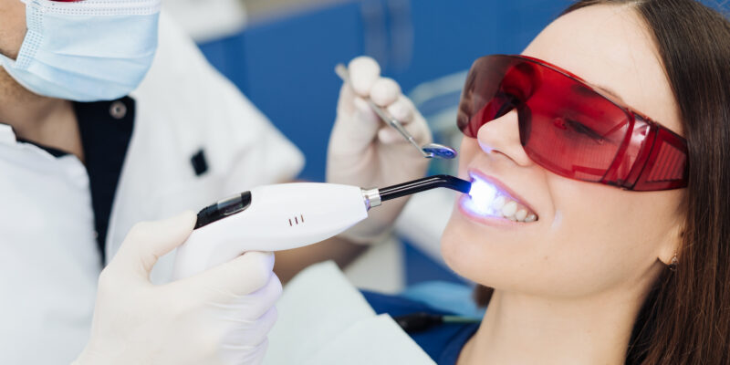Clareamento dental: o que é, como funciona e quais os resultados