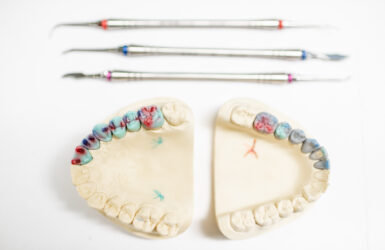 Passo a passo do tratamento com prótese protocolo