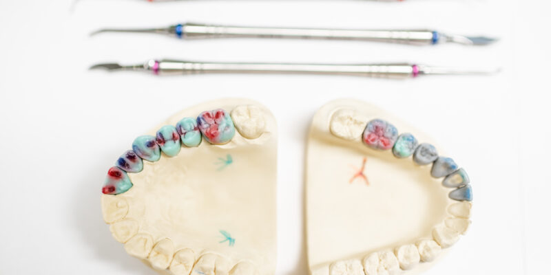 Passo a passo do tratamento com prótese protocolo