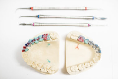 Passo a passo do tratamento com prótese protocolo