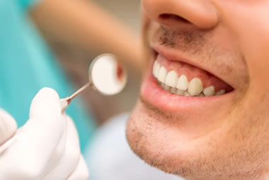 Gengiva após implante dentário - 2