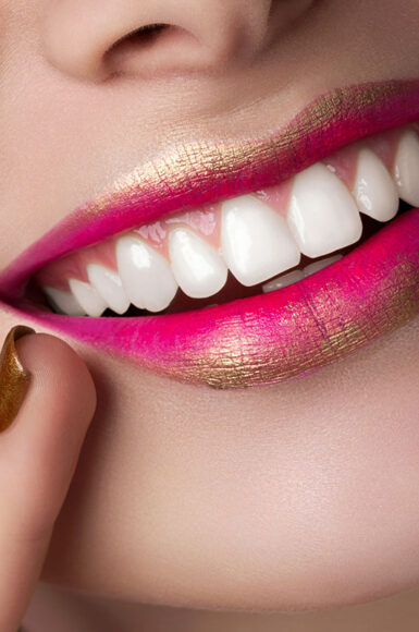 Clareamento Dental Profissional para um Sorriso Mais Branco