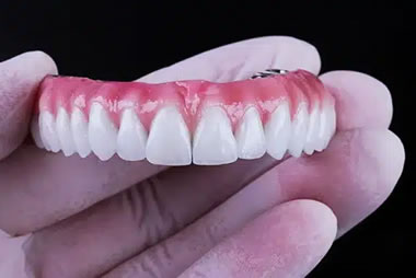 prótese-dentária-fixa