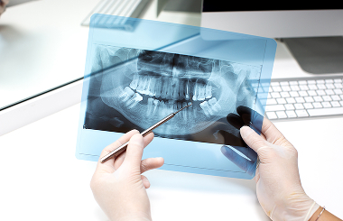 5 Sinais de que você precisa de um dentista que cuida de canal urgente
