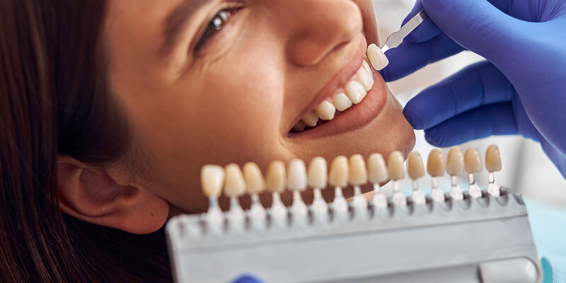 Cuidados com Lentes de Porcelana_ Guia Completo 2026