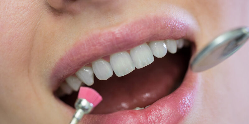 Dente de Porcelana Vale a Pena_ Guia Completo 2026