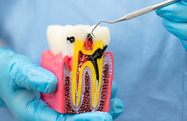 Dentista que cuida de canal_ Sinais de que a dor de dente precisa de urgência