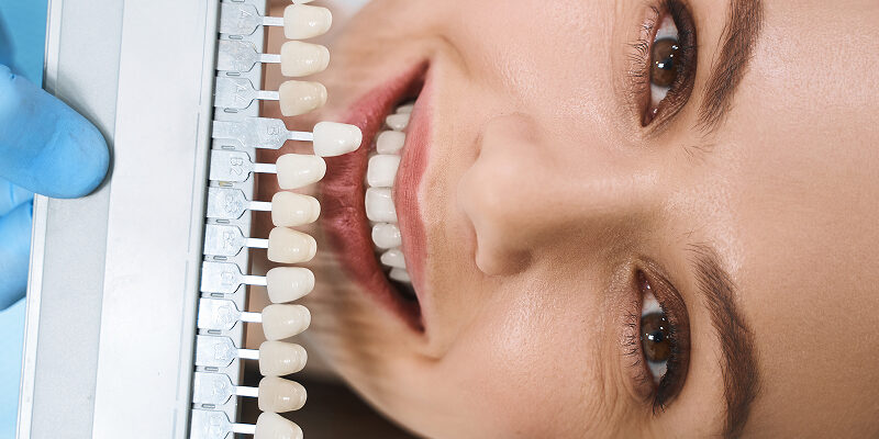 Faceta Dental_ Transforme Seu Sorriso _ Siguimi