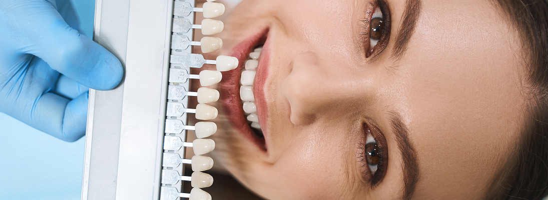 Faceta Dental_ Transforme Seu Sorriso _ Siguimi
