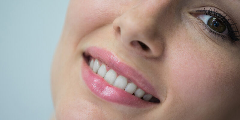 Facetas nos Dentes_ Passo a Passo Completo do Tratamento