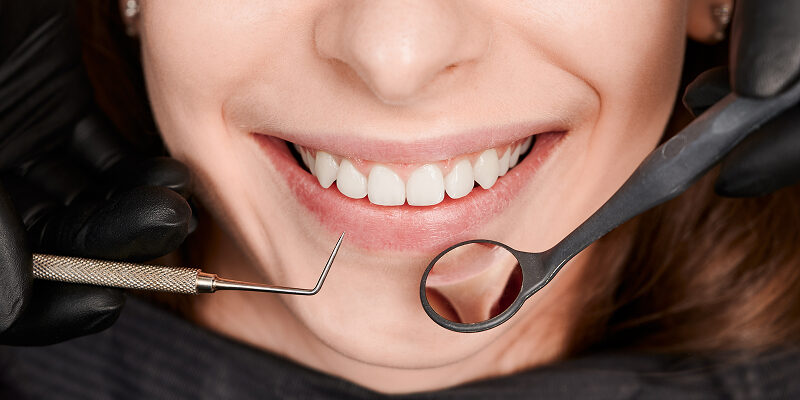 Lente ou Faceta de Porcelana_ Qual a Diferença_ _ Guia