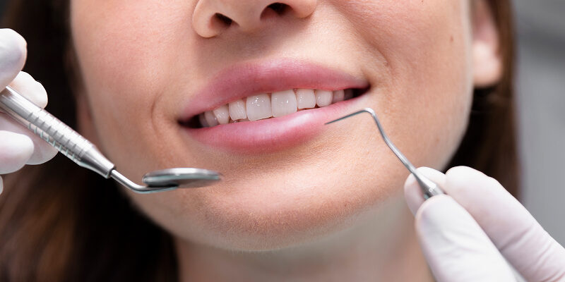 Quanto Custa Lente de Porcelana em 2025_