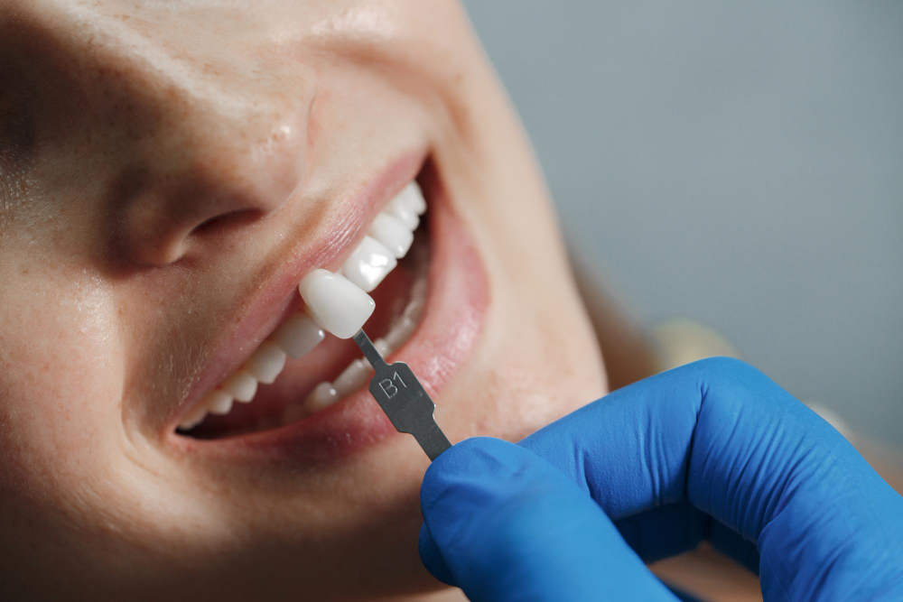 Implante Dentário em Goiânia: Guia Completo 2026