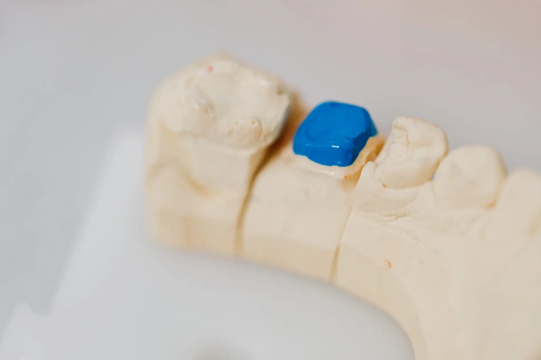 Comparativo de procedimentos de estética dental em ficha clínica