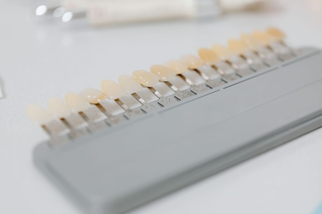 Facetas de porcelana ultrafinas sobre modelo dentário em clínica