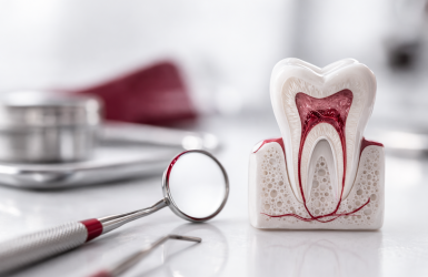 canal - endodontia