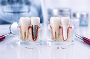 diferença de titaneo e zirconia