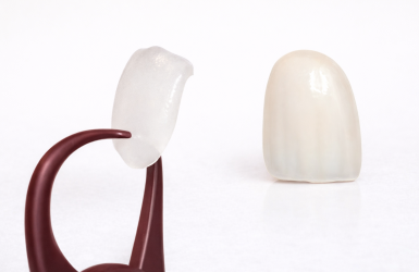 diferença entre lente e porcelana
